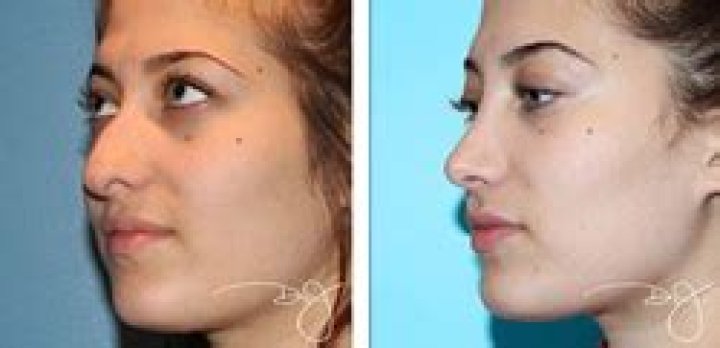 Celebrity Plastic Surgery Patients with Happy Stories to Tell Illustrate the Overwhelmingly Positive Outcomes of Most Procedures, Says Dr. J Plastic Surgery