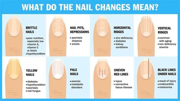 What Your Nails Say About Your Personality? Nail shapes meaning Decoded -